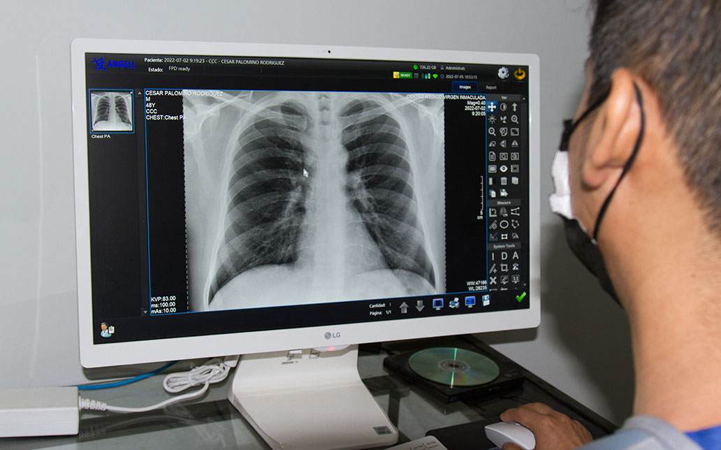 Exámenes Auxiliares y Procedimientos